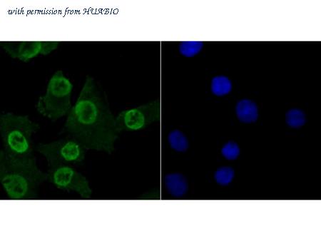 HUABIO ET7107-78 image 2