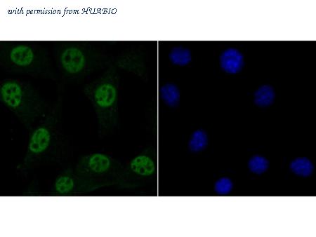HUABIO ET7107-78 image 3