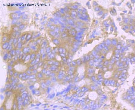 HUABIO ET7107-83 image 1