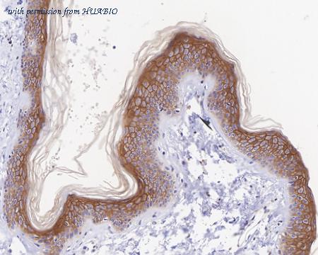 HUABIO ET7107-83 image 2