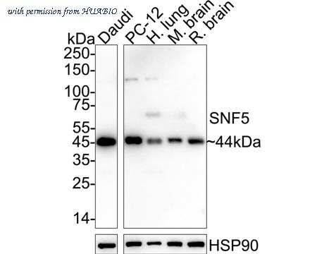 HUABIO ET7107-84 image 1