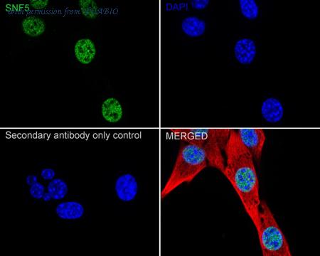 HUABIO ET7107-84 image 2