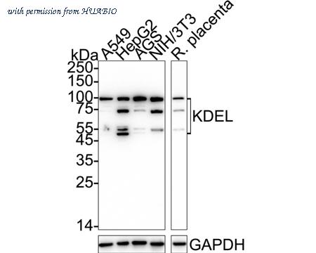HUABIO ET7107-86 image 1