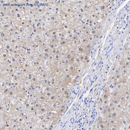 HUABIO ET7107-90 image 2