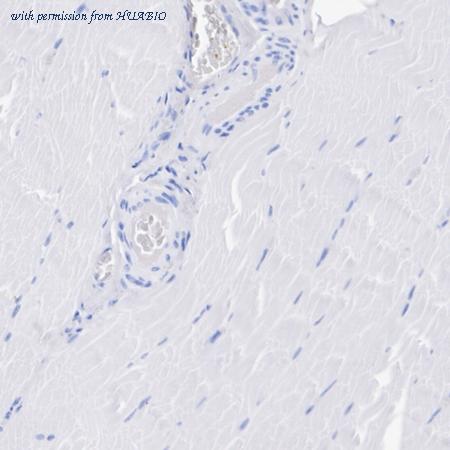 HUABIO ET7107-90 image 3