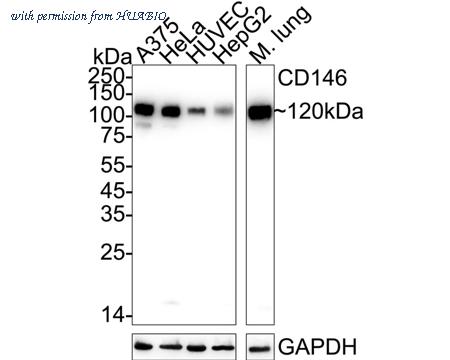 HUABIO ET7107-91 image 1