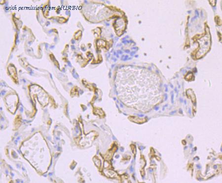 HUABIO ET7107-92 image 3