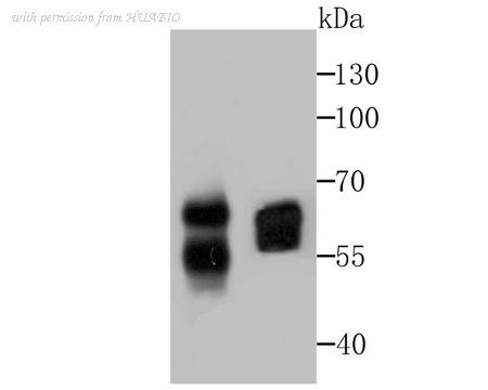 HUABIO ET7107-94 image 2