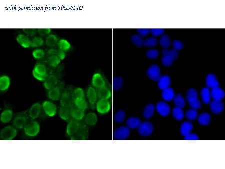 HUABIO ET7107-98 image 3