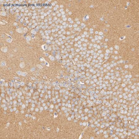 HUABIO ET7108-04 image 2