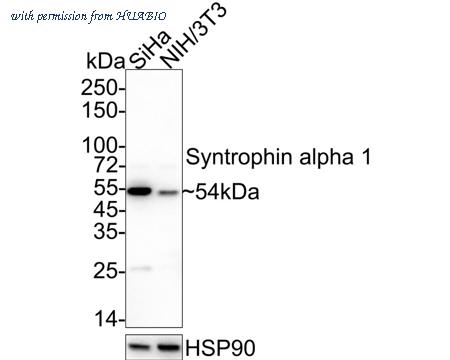 HUABIO ET7108-15 image 1