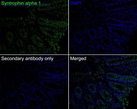 HUABIO ET7108-15 image 2