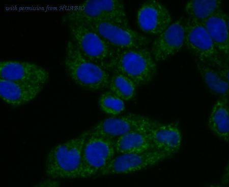 HUABIO ET7108-16 image 2