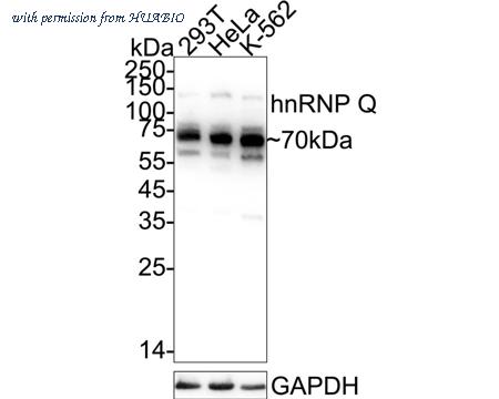 HUABIO ET7108-17 image 1