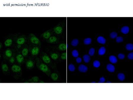 HUABIO ET7108-17 image 3