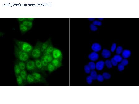 HUABIO ET7108-18 image 2