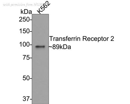 HUABIO ET7108-21 image 1