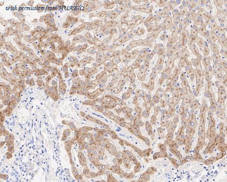 HUABIO ET7108-21 image 2