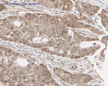 HUABIO ET7108-22 image 2