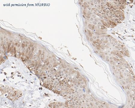 HUABIO ET7108-22 image 3