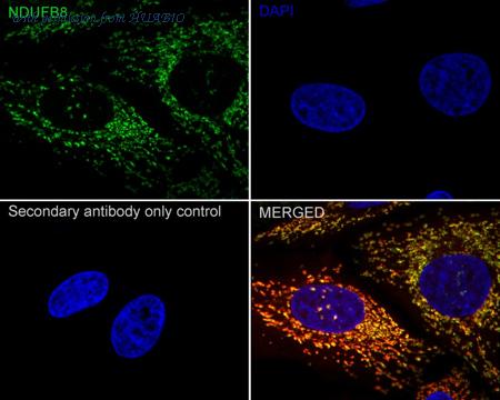 HUABIO ET7108-25 image 3