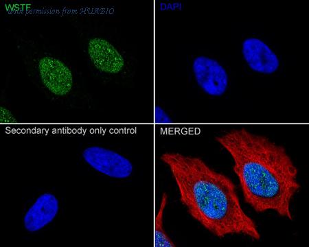 HUABIO ET7108-32 image 2