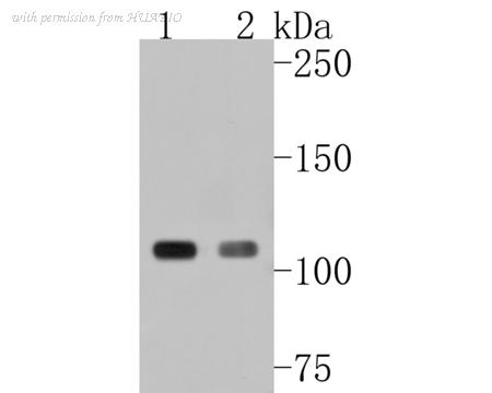 HUABIO ET7108-34 image 1