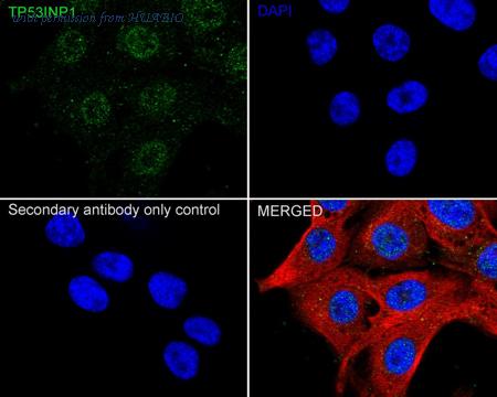 HUABIO ET7108-35 image 2