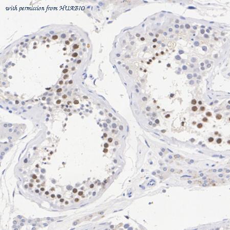 HUABIO ET7108-37 image 3