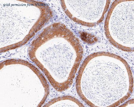 HUABIO ET7108-40 image 2