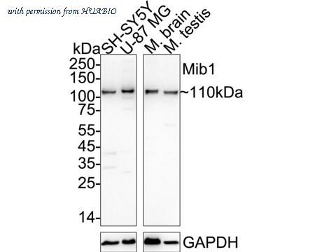 HUABIO ET7108-43 image 1