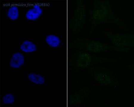 HUABIO ET7108-51 image 3