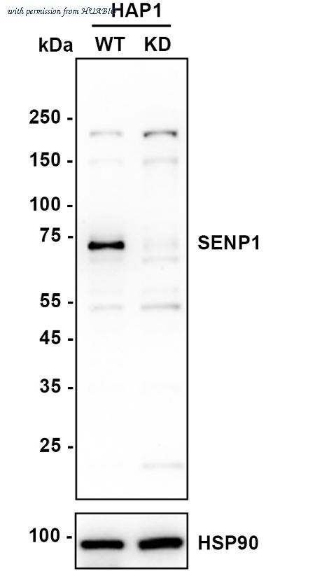 HUABIO ET7108-53 image 1