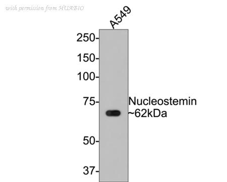 HUABIO ET7108-55 image 1