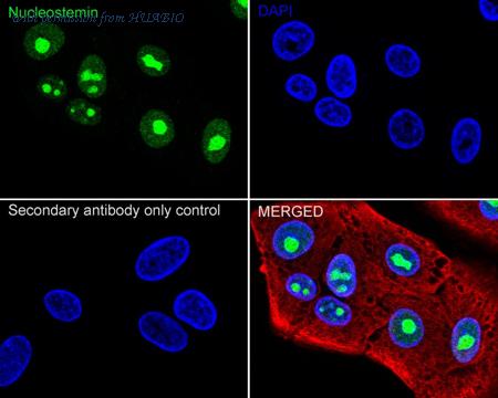 HUABIO ET7108-55 image 2