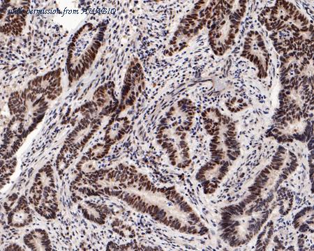 HUABIO ET7108-55 image 3