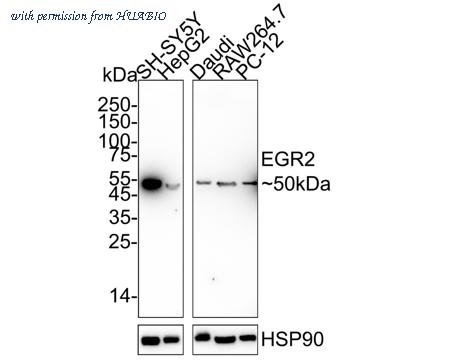 HUABIO ET7108-57 image 1