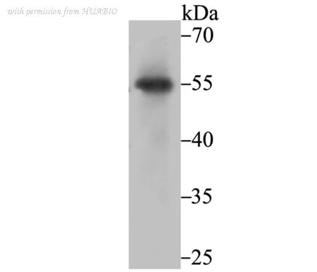 HUABIO ET7108-59 image 1