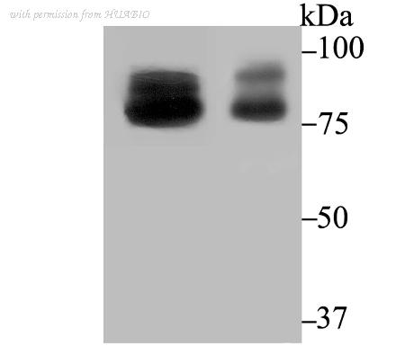 HUABIO ET7108-61 image 2