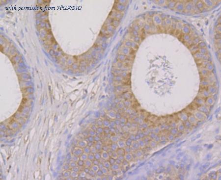 HUABIO ET7108-61 image 3