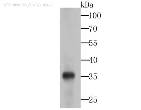 HUABIO ET7108-63 image 1