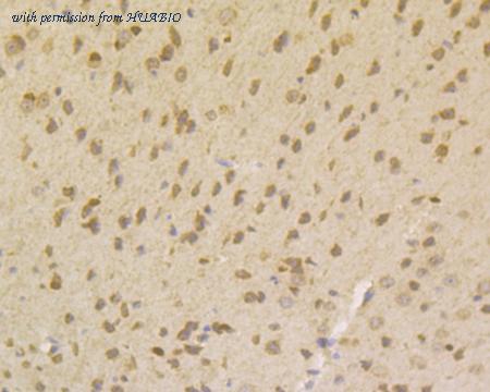 HUABIO ET7108-63 image 3