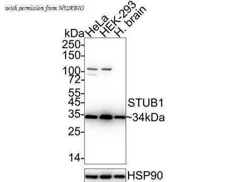 HUABIO ET7108-65 image 1