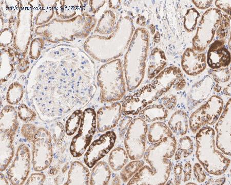 HUABIO ET7108-66 image 3