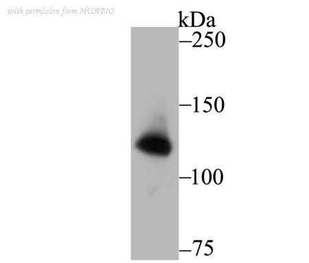HUABIO ET7108-70 image 1