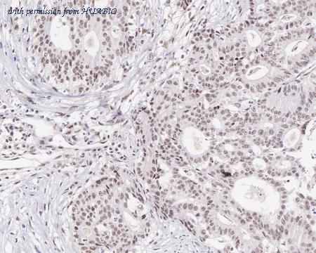 HUABIO ET7108-71 image 3