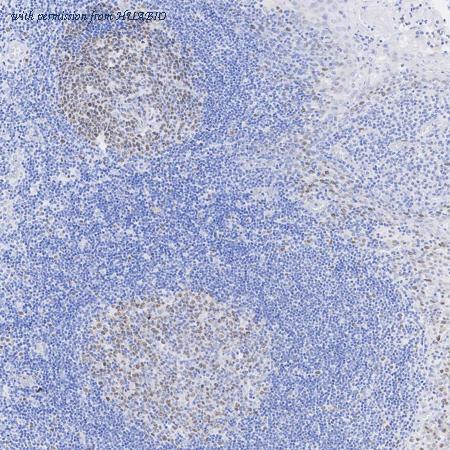 HUABIO ET7108-85 image 2