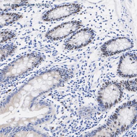 HUABIO ET7108-85 image 3