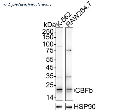 HUABIO ET7108-87 image 1