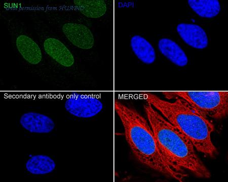 HUABIO ET7108-91 image 2
